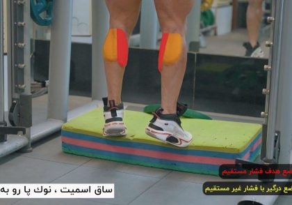 ساق اسمیت، نوک پا رو به بیرون